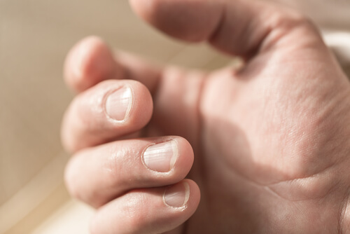 Linien Auf Den Nageln Und Wie Man Sie Los Wird Besser Gesund Leben