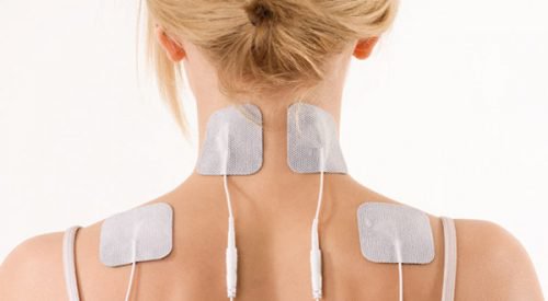 Behandlung einer Frozen Shoulder mit Kapsulitis