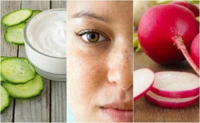 5 Hausmittel gegen Hautflecken im Gesicht