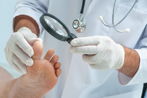Arzt untersucht Fuß und Patient verwendet Knoblauch als Naturheilmittel gegen Fußpilz