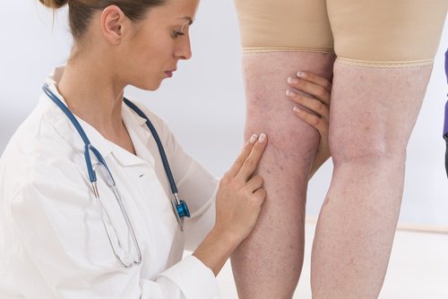 Vorteile von Gelatine: Reduktion von Schwellungen an den Beinen