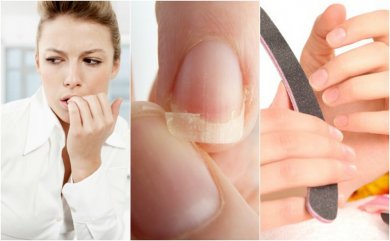8 Gründe für splitternde, brüchige Fingernägel