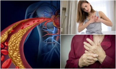 Ist dein Cholesterinspiegel zu hoch?