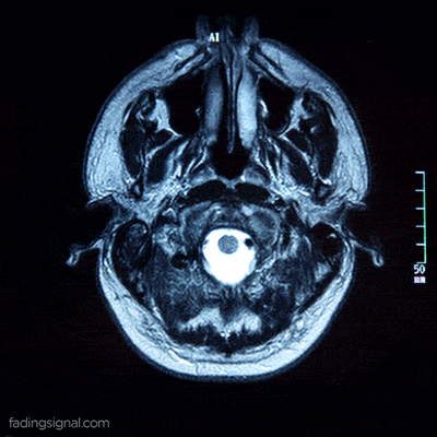 Neurochemie und Schlaf