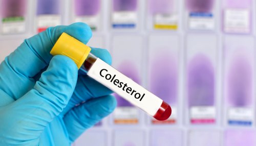 täglich Honig reguliert den Cholesterinspiegel