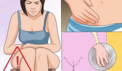 Vaginale Candidose: Ursachen, Symptome und Behandlung
