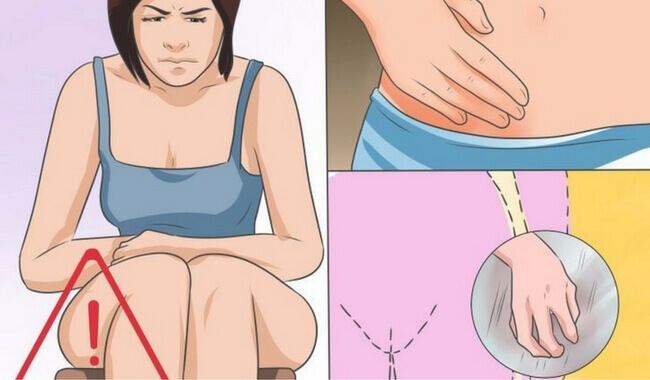 Vaginale Candidose: Ursachen, Symptome und Behandlung