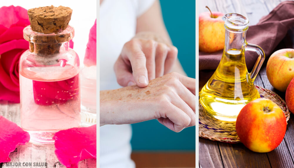 8 Naturheilmittel für ebenmäßige Hände 8 Naturheilmittel für ebenmäßige Hände