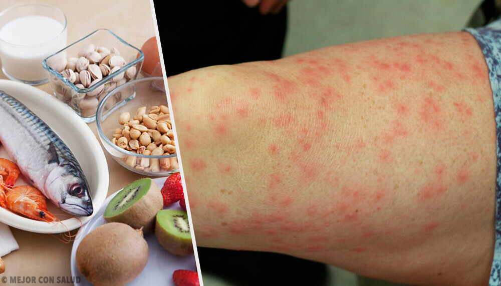 Allergene Lebensmittel und wie du sie ersetzen kannst Allergene Lebensmittel und wie du sie ersetzen kannst