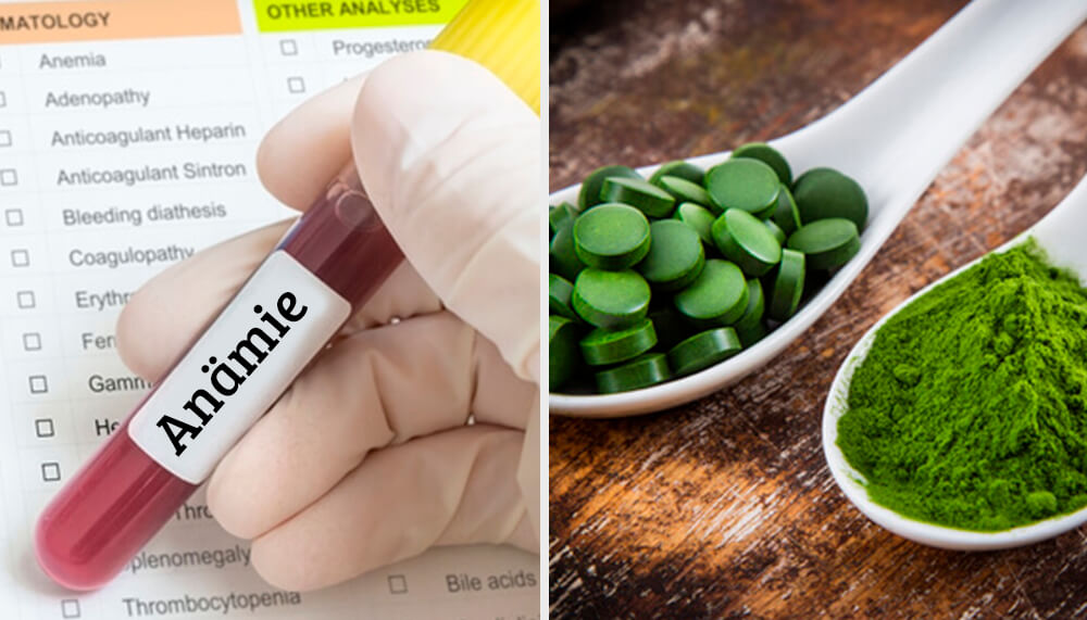 Sieben Alarmsignale von Blutarmut bei Kindern