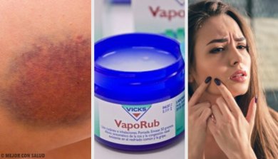 11 alternative Einsatzmöglichkeiten für Wick VapoRub