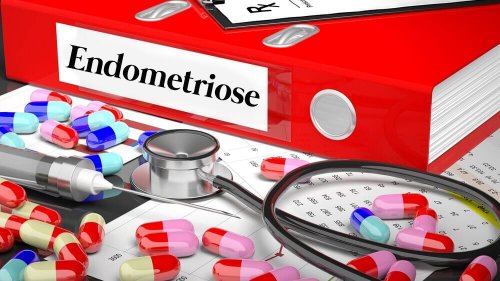 Krankheit Endometriose