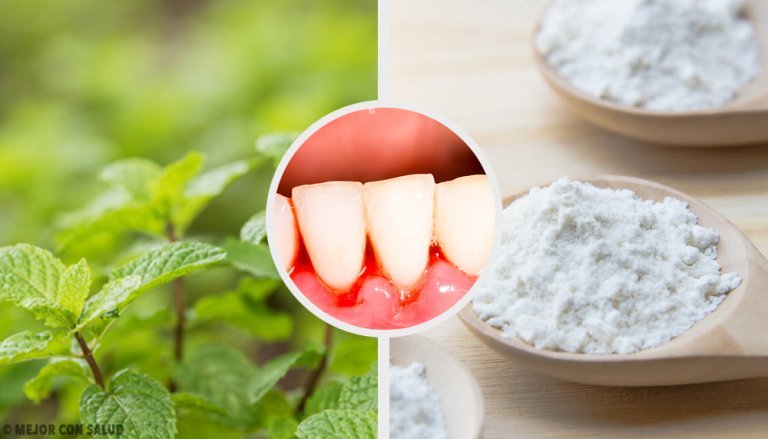 Was tun bei einer Zahnfleischentzündung? 5 Tipps