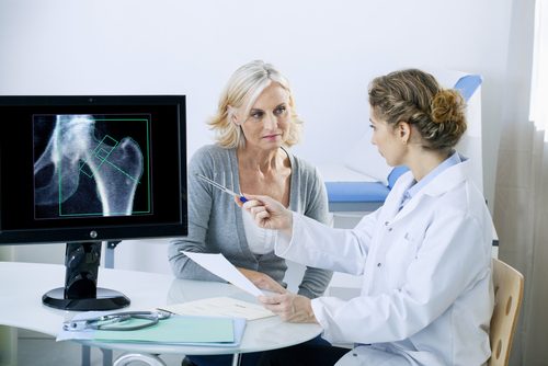 Erkennung und andere wissenswerte Dinge über Osteoporose