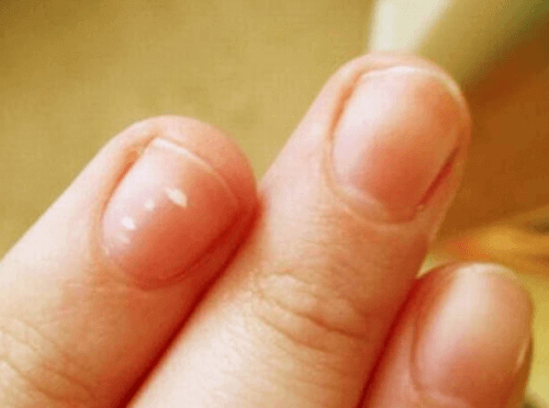 Die Lunula des kleinen Fingers kann wichtige Informationen geben.
