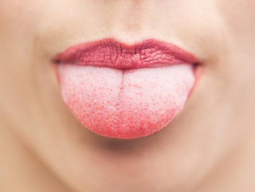 Gesunde Morgenrituale: Reinigung der Zunge