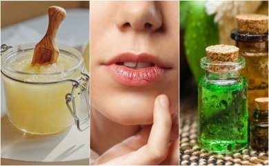 Trockene, rissige Lippen behandeln
