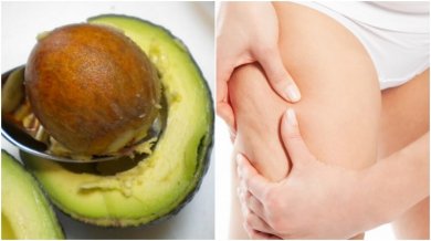 Wie du Avocadokerne gegen Cellulite einsetzen kannst