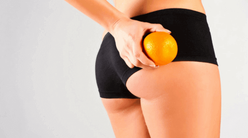 7 natürliche Mittel gegen Cellulite