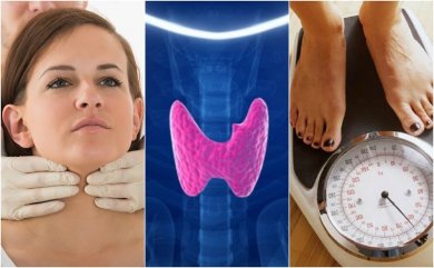 Welche Anzeichen für Hypothyreose gibt es?
