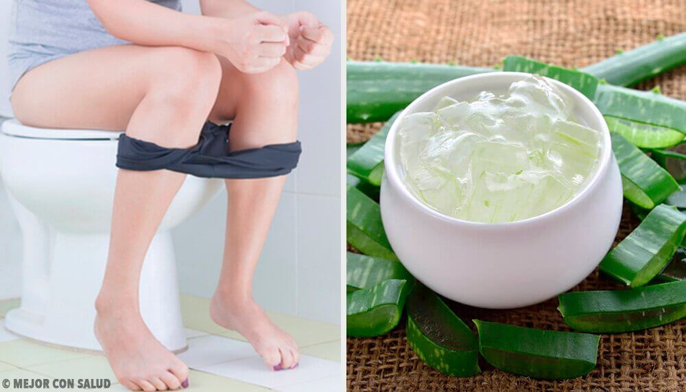 Ergänzende Behandlung bei Hämorrhoiden