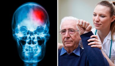 Hirnschlag: Symptome und Risiken