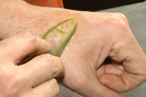 Aloe-Pflanze gegen Sonnenbrand