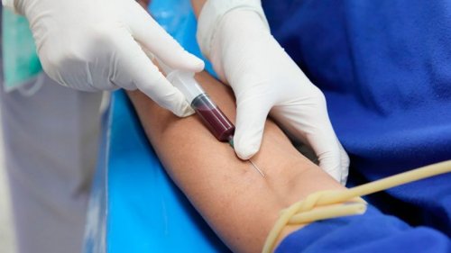 Symptome von Diabetes analysieren