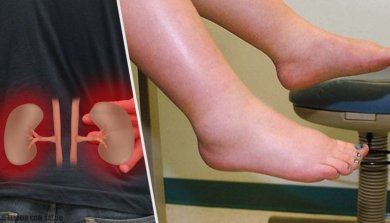 Ursachen für Flüssigkeitsretention