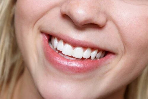 4 Mandeln am Tag für die Zahngesundheit