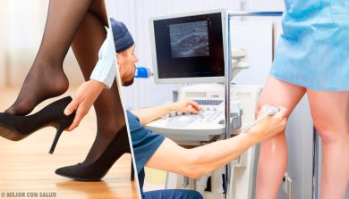 3 natürliche Tipps gegen Krampfadern