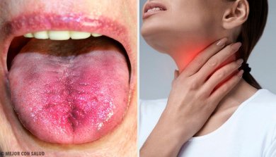 6 Formen wie du herausfinden kannst, ob dein Hals belegt ist