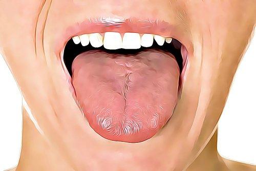 6 Heilmittel gegen Geschwüre im Mund