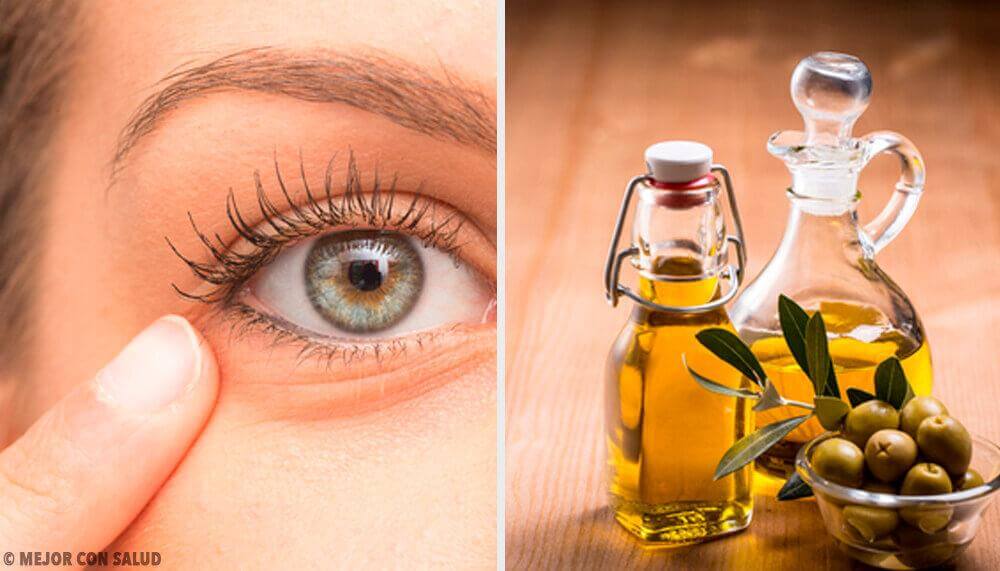 6 natürliche Heilmittel gegen Augenentzündungen