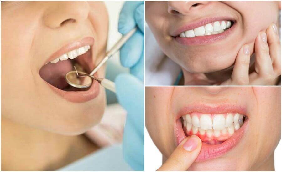 7 Anzeichen einer Zahninfektion