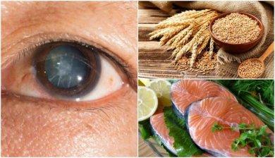 7 Lebensmittel zur Vorsorge gegen Katarakte