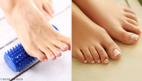 Hallux valgus ohne Operation behandeln?