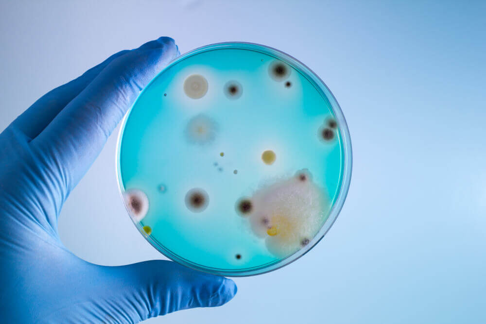 Hüte dich vor diesen 9 gefährlichen Bakterien