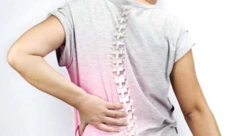 Skoliose kann Rückenschmerzen verursachen