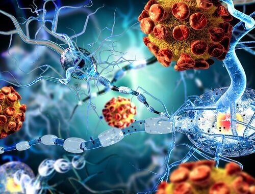 Was ist Meningitis?