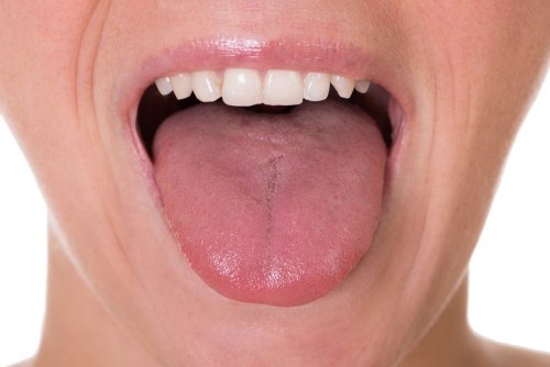 Zunge untersuchen, wenn der Hals belegt ist