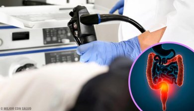 Behandlung von Darmkrebs: alles, was du darüber wissen solltest