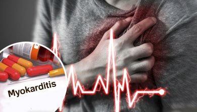 Was ist eine Myokarditis?