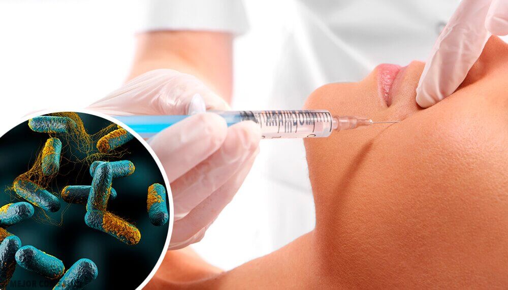 Botulinumtoxin - ein tödliches Gift