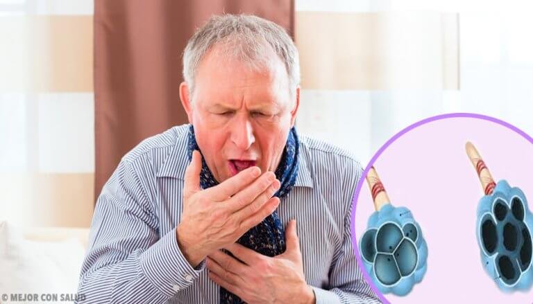 Chronisch obstruktive Lungenerkrankung (COPD)