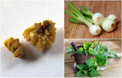 Natürliche Heilmittel gegen Harnsäurekristalle