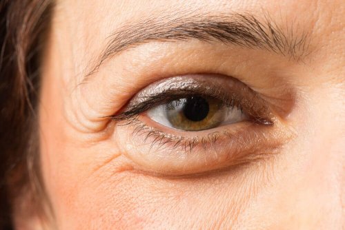 Tipps gegen Augenringe