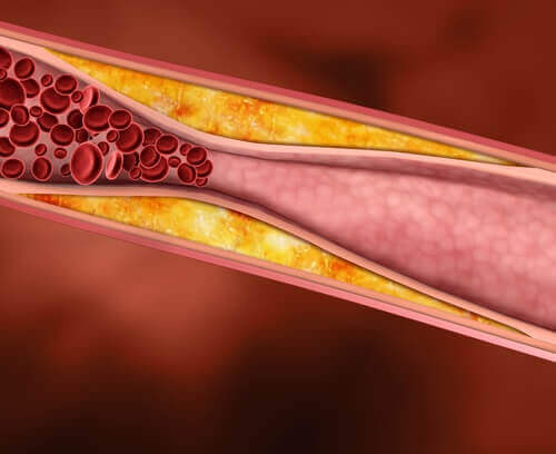 Vorteile von Traubensaft - Reduziert den Cholesterinspiegel