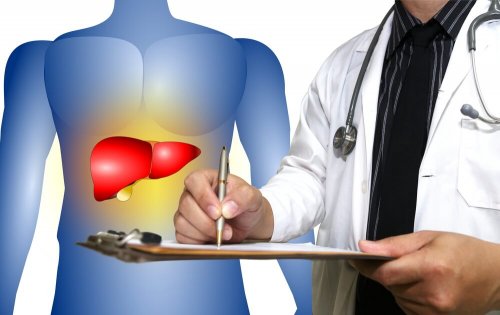 Natürliche Heilmittel, mit denen du eine Fettleber bekämpfen kannst