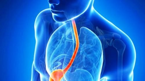 Die effektivsten natürlichen Mittel zur Behandlung von Reflux